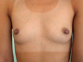 激レア！日焼けクッキリAAA-CUP微乳少女ひまりチャン。留学中の東南アジアから一時帰国、緊急AV出演。　サンプル画像03